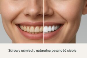 Zestawienie typu przed i po przedstawiające uśmiechniętą kobietę z żółtawym odcieniem zębów po lewej stronie i śnieżnobiałym uśmiechem po prawej.