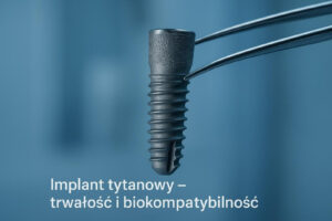 Zbliżenie na tytanową śrubę implantu stomatologicznego trzymaną w pęsecie na niebieskim tle.