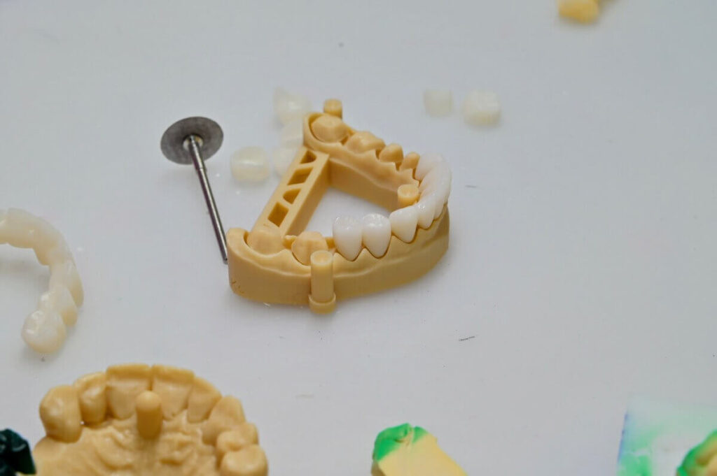 Wielopunktowy most ceramiczny osadzony na modelu technicznym; obok widoczne pojedyncze korony zębowe oraz wiertło protetyczne na białym blacie roboczym.