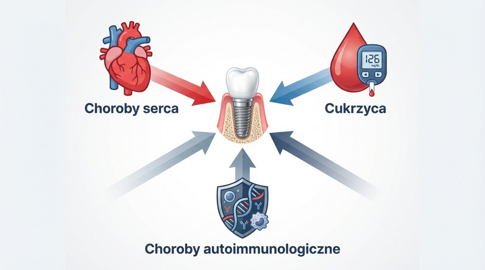 Ilustracja przedstawiająca powiązania pomiędzy chorobami serca, cukrzycą, chorobami autoimmunologicznymi a implantami dentystycznymi